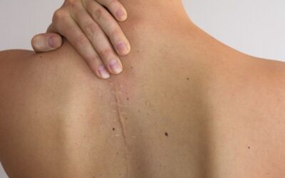 Scar Tissue Massage Therapy